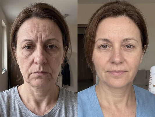 Пчелен мехлем против бръчки